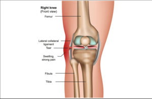 lateral collateral ligament