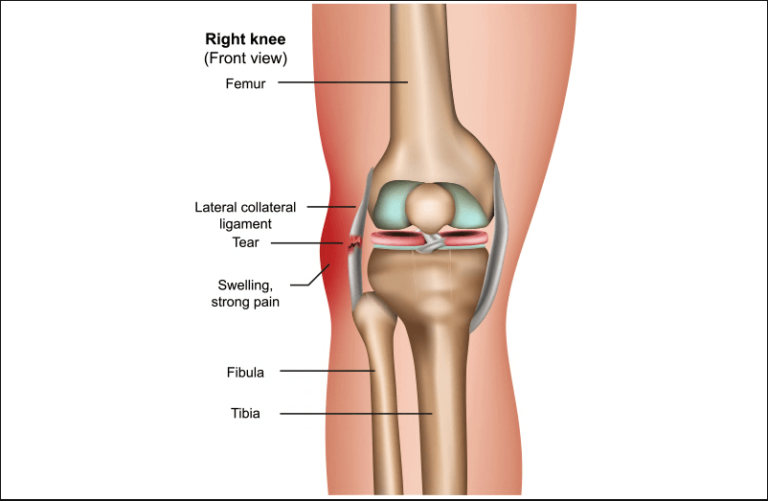 lateral collateral ligament