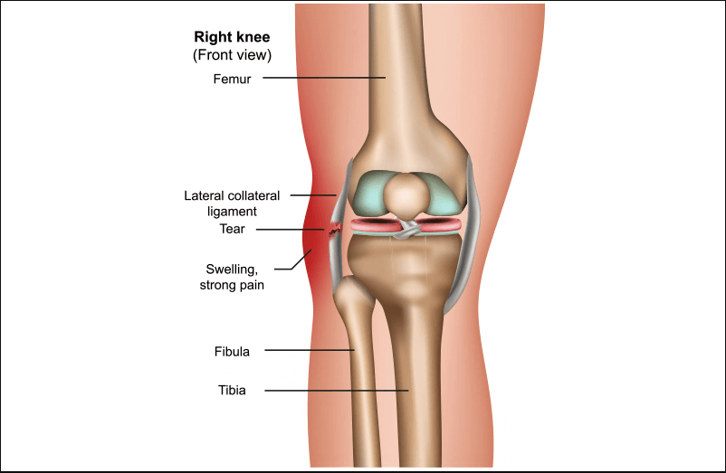 lateral collateral ligament