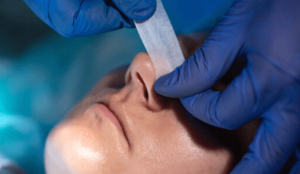Septoplasty: A Guide to Nasal Septum Surgery