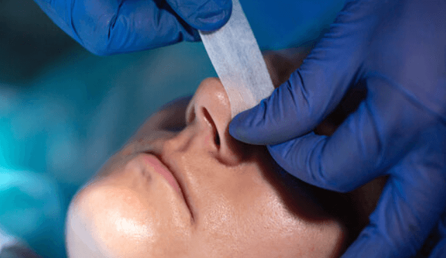 Septoplasty: A Guide to Nasal Septum Surgery