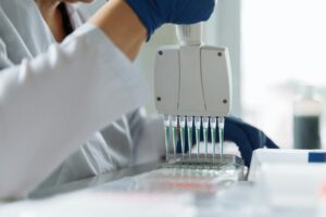 biochemistry glutamyltranspeptidase enzyme searches